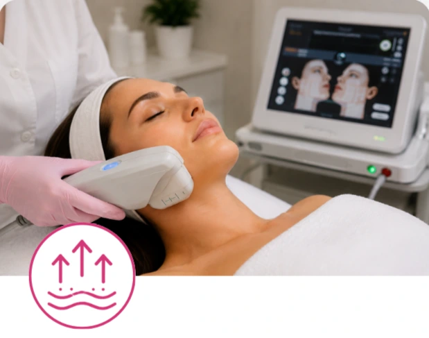 Ultherapie
